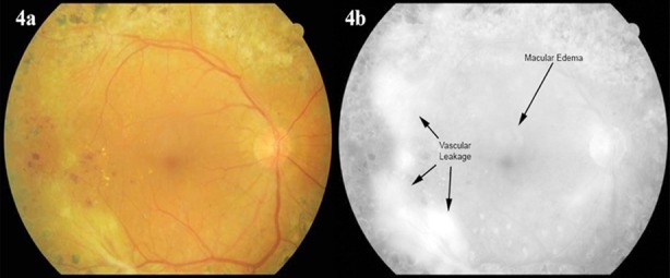 Fig.4