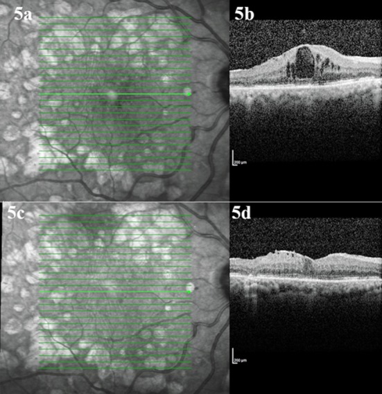 Fig.5