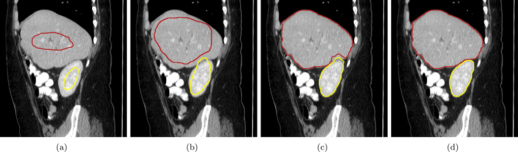 Figure 17