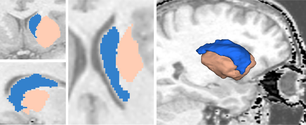 Figure 13