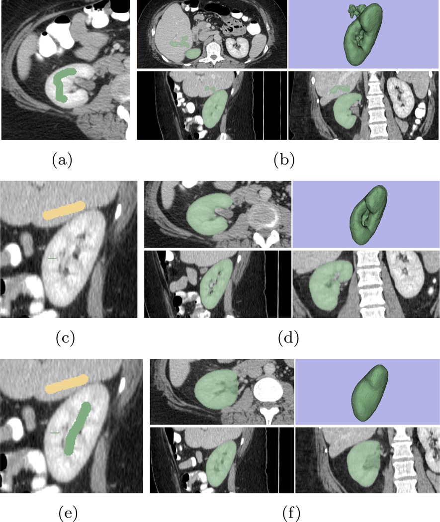 Figure 15