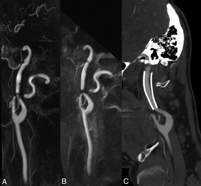 Fig 3.