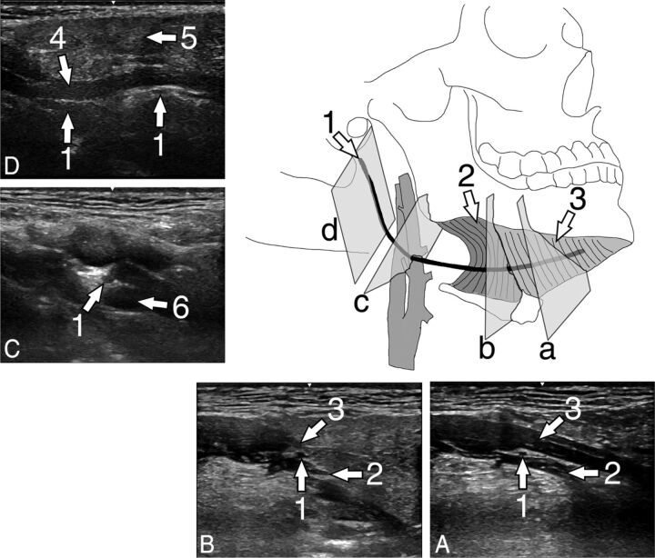 Fig 1.