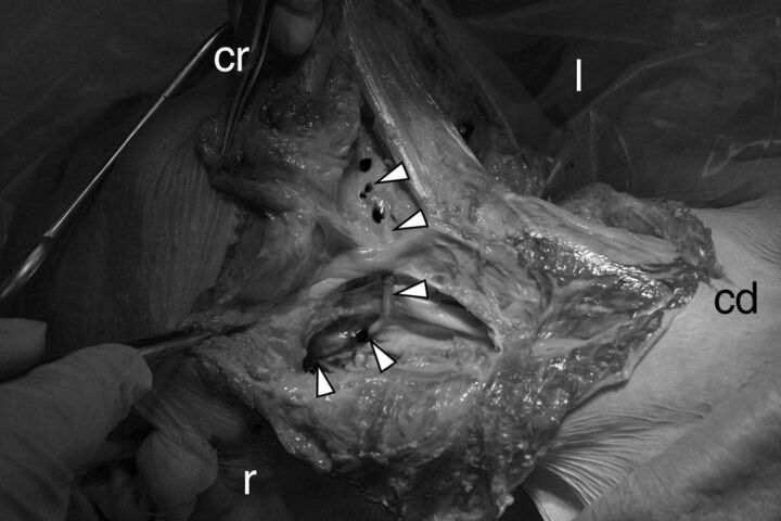 Fig 2.