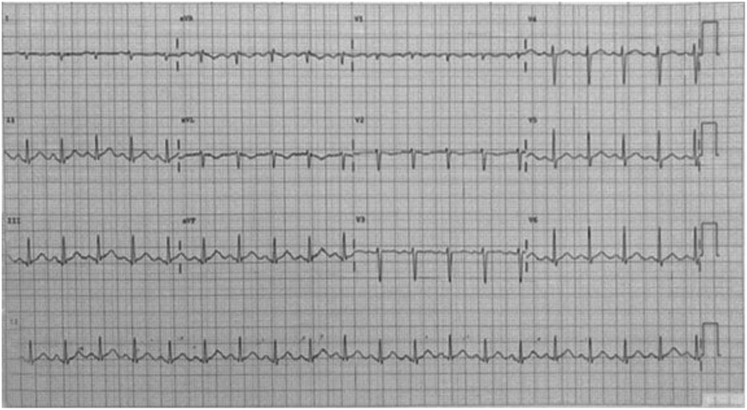 Figure 4