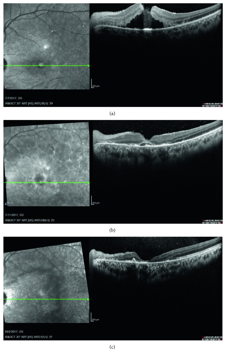 Figure 2