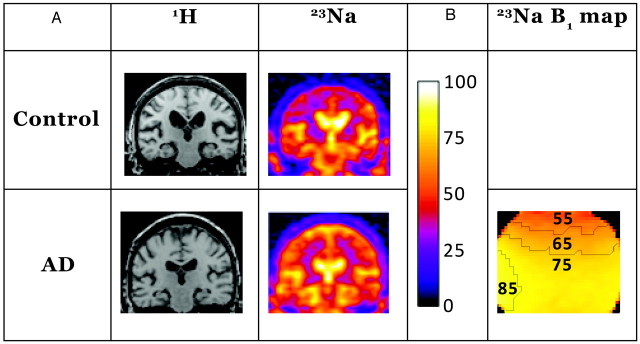 Fig 1.