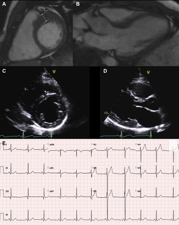 Figure 3