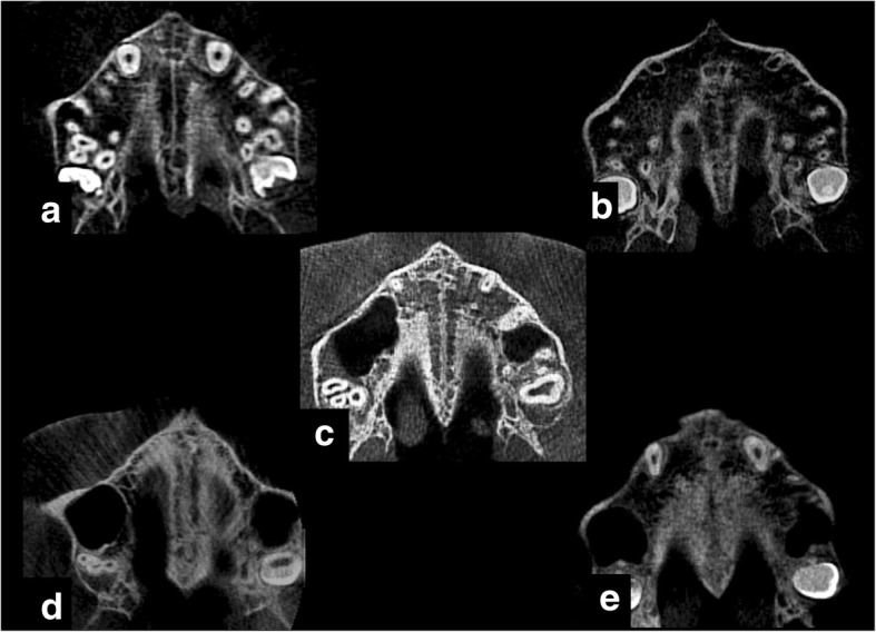 Fig. 2