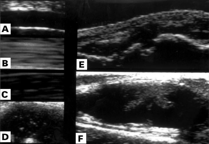 Figure 1  