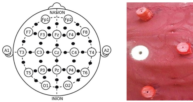 Figure 2)