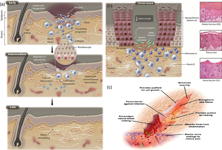 FIGURE 11