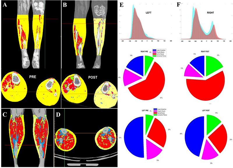 Fig 3.