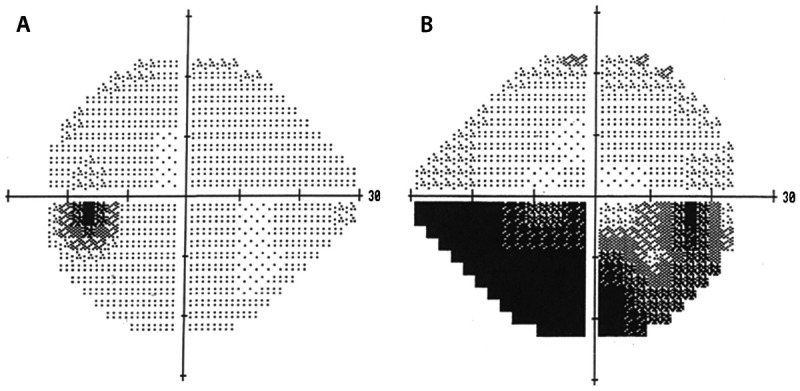 Figure 3-17.