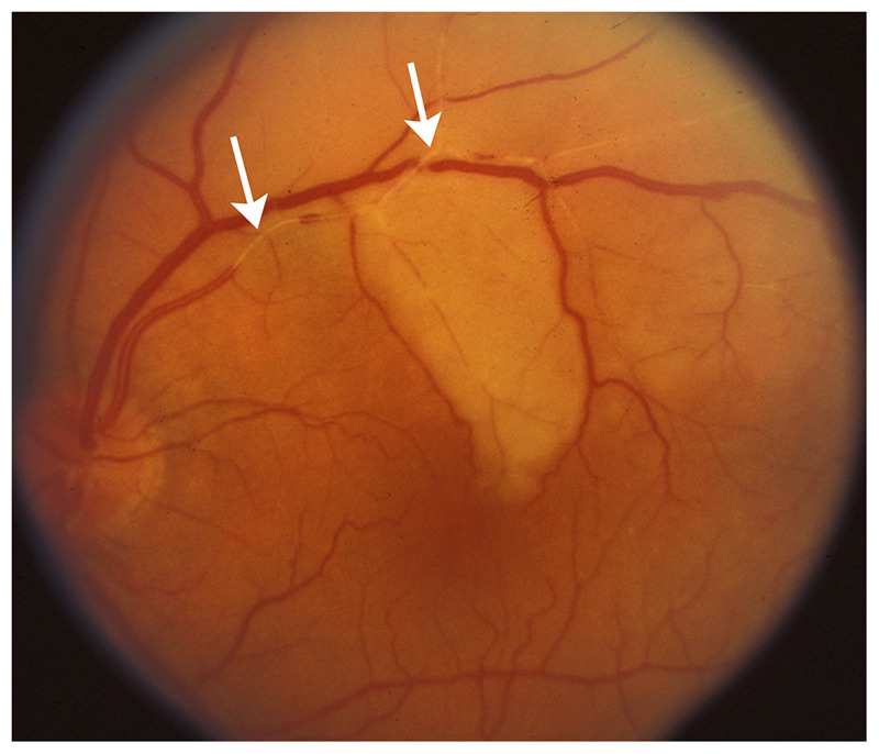 Figure 3-3.