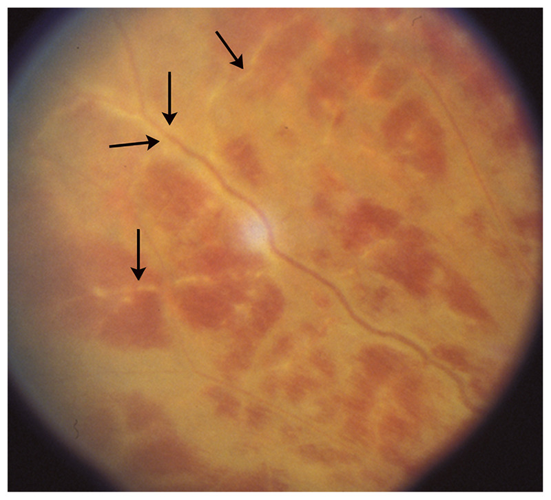 Figure 3-12.