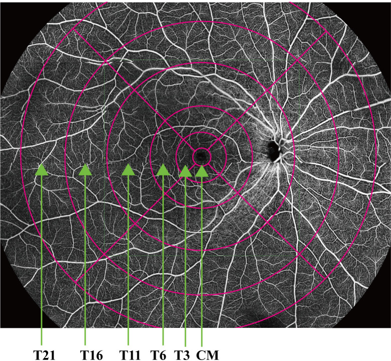 Figure 2