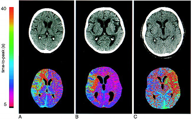 fig 2.