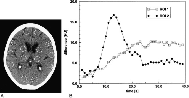 fig 1.