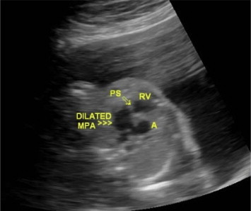 Fig. 2