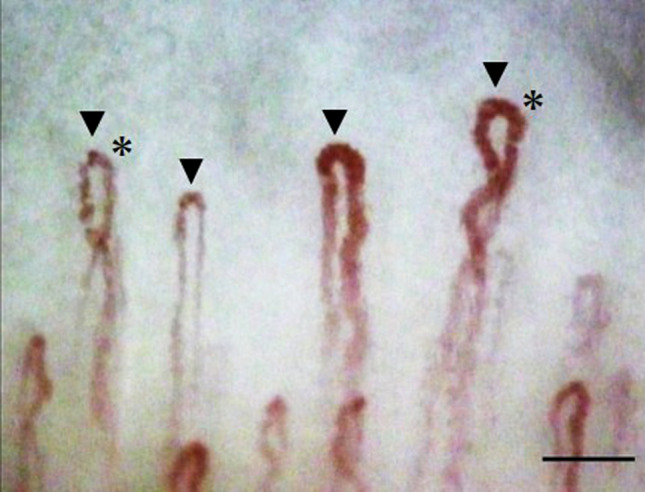 Fig. 2