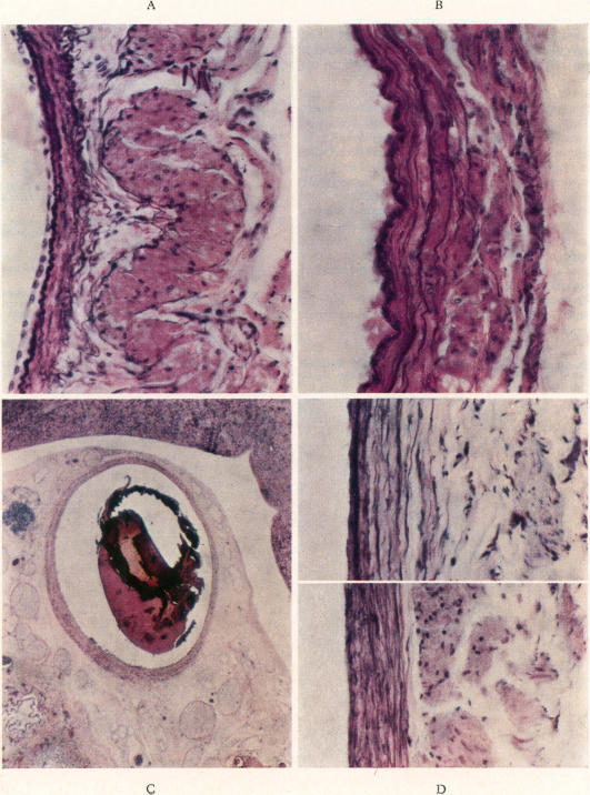 Colour Plate