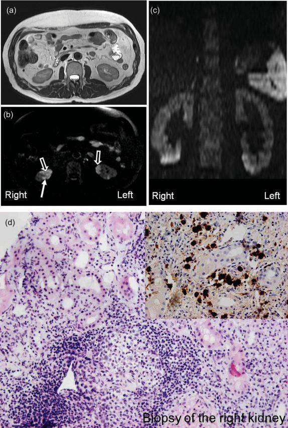 Fig. 2.