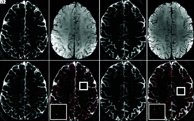 FIG 1.