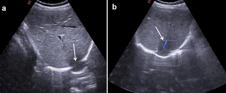 Fig2 – US