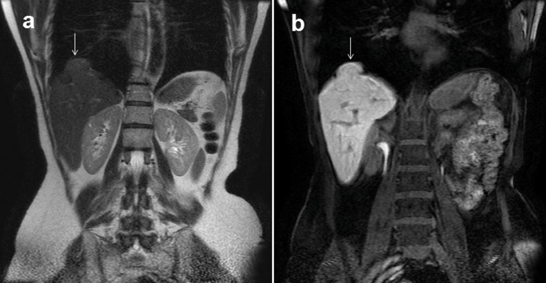 Fig3 – MR