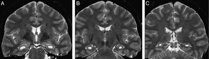 Fig 1.