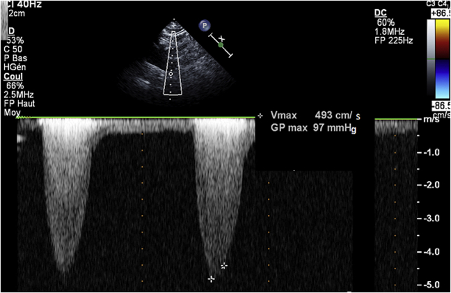 Figure 1