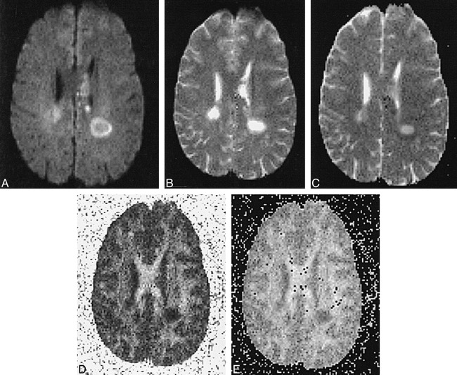 fig 2.