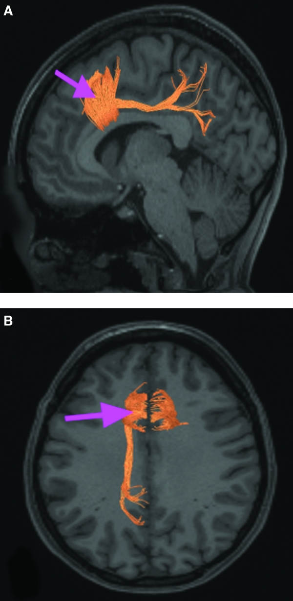 FIGURE 18.