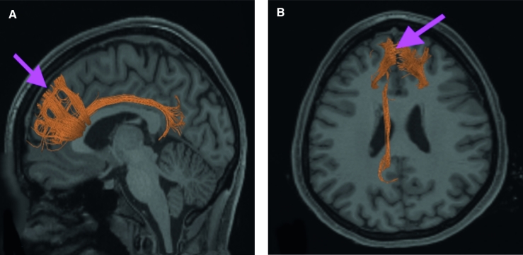 FIGURE 36.