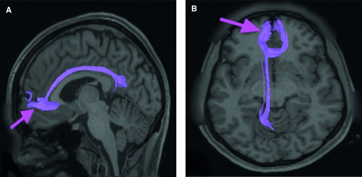 FIGURE 38.