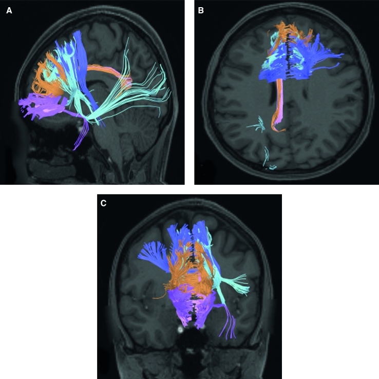 FIGURE 30.