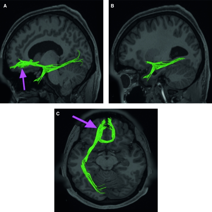 FIGURE 44.