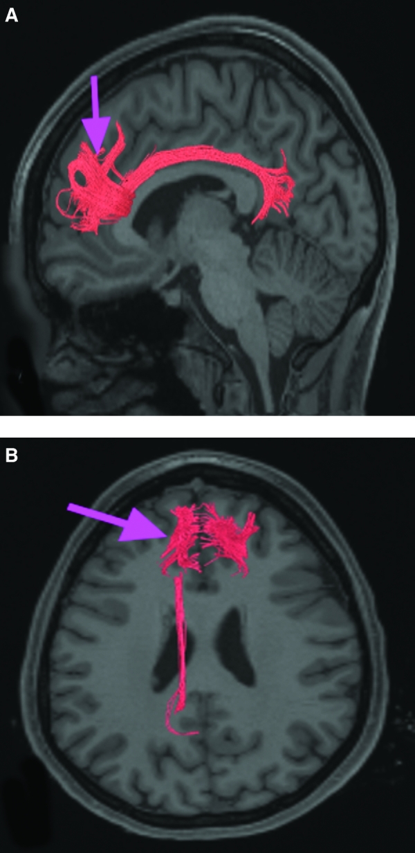 FIGURE 22.