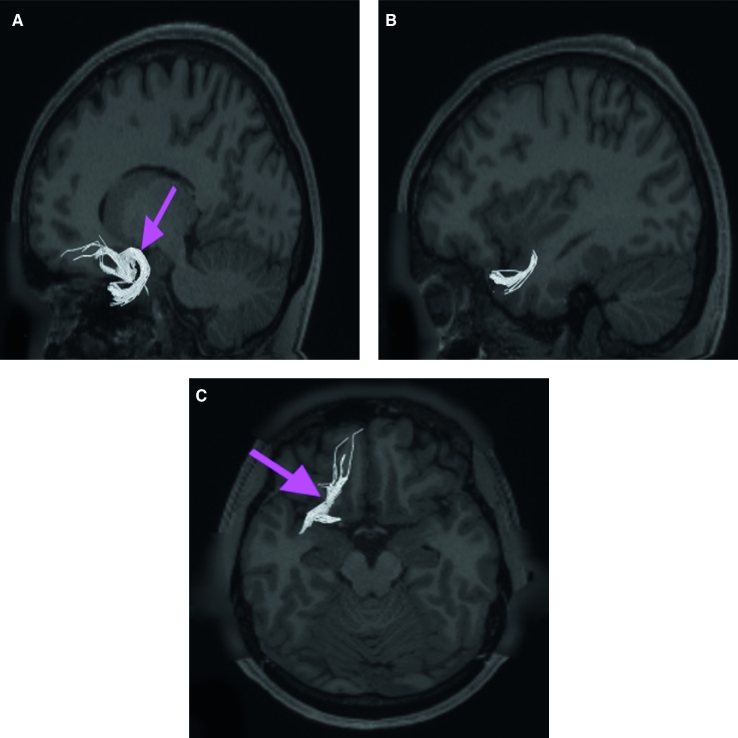 FIGURE 46.