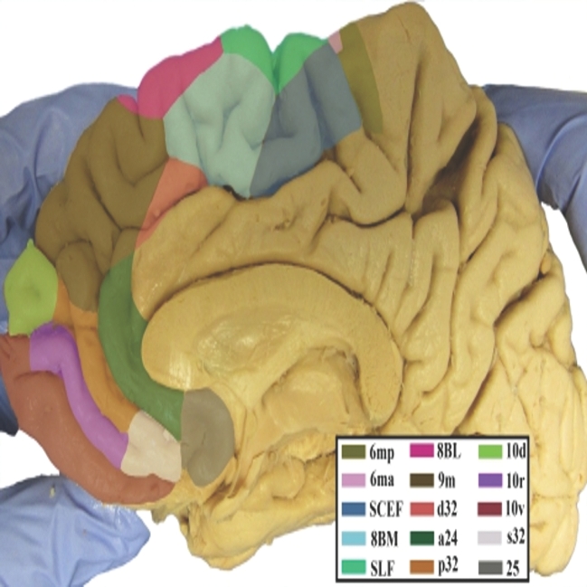 FIGURE 29.