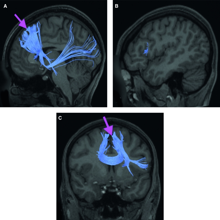 FIGURE 34.