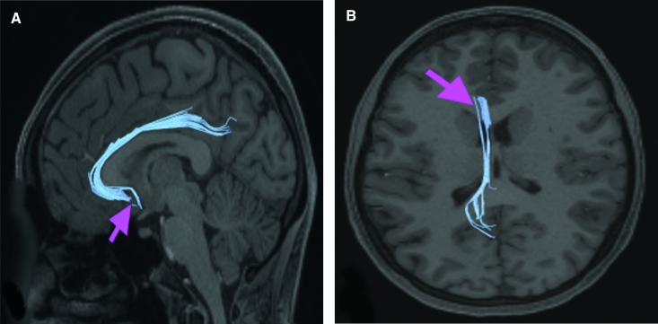 FIGURE 28.