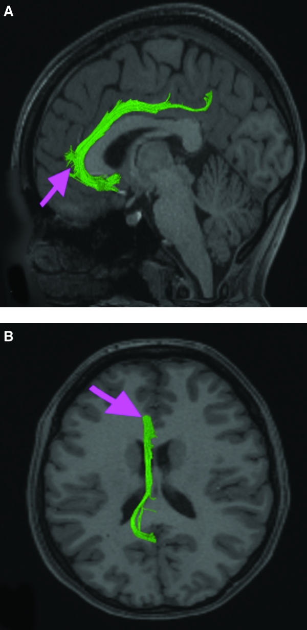 FIGURE 16.