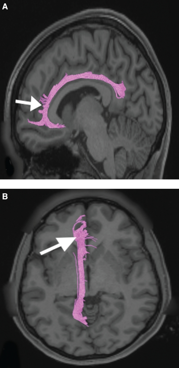 FIGURE 14.