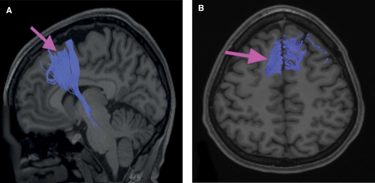 FIGURE 32.