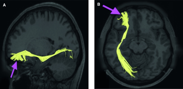 FIGURE 48.