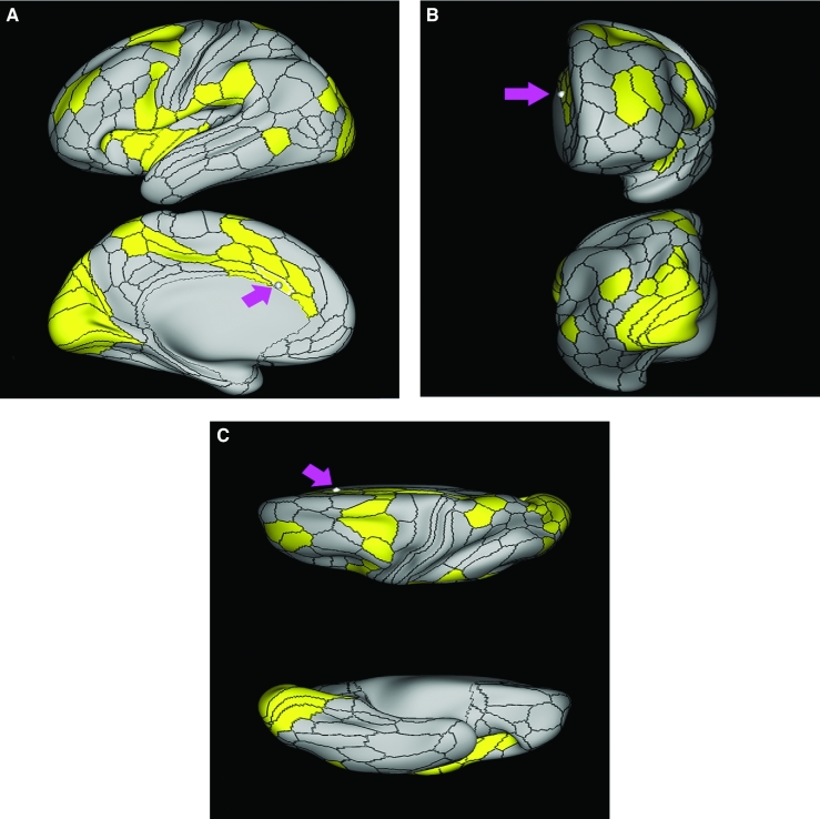 FIGURE 11.