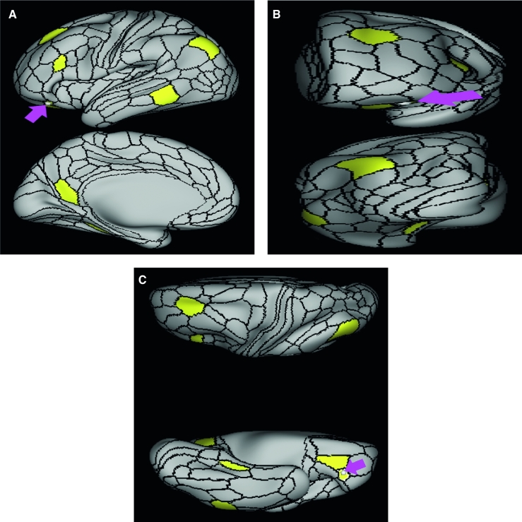 FIGURE 51.