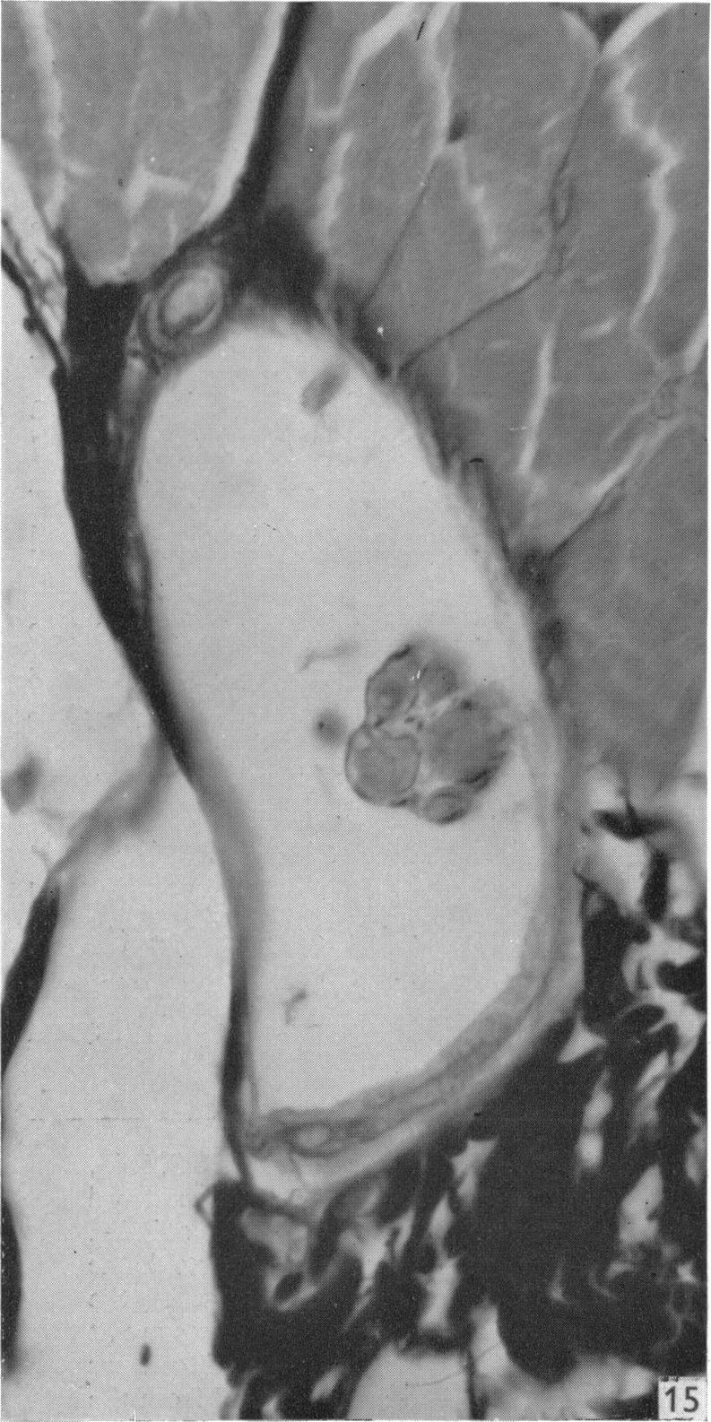 Fig. 15